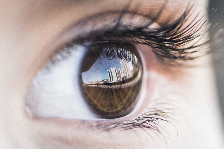 טיפול EMDR חרדות הוא יישום ייחודי של השיטה, המכוון לסייע לאנשים המתמודדים עם קשת רחבה של הפרעות חרדה